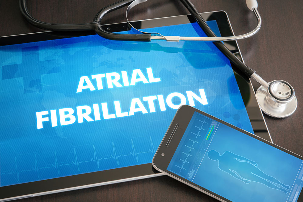 All you need to know about atrial fibrillation