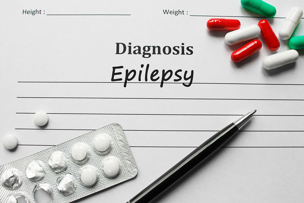 An overview of epilepsy