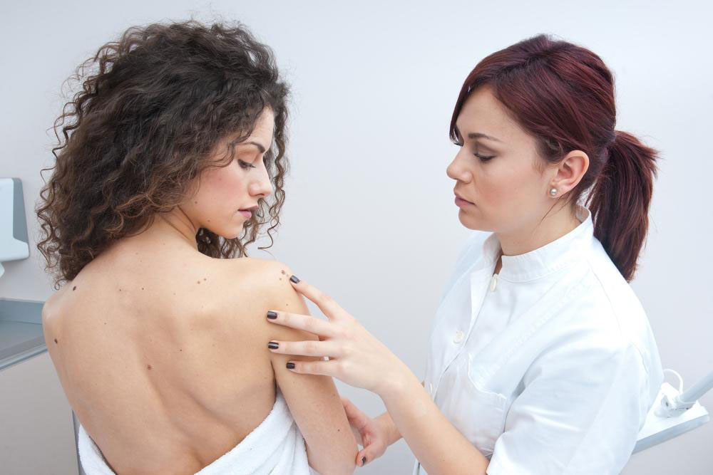 An overview of melanoma