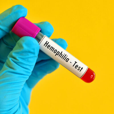 Things you need to know about hemophilia