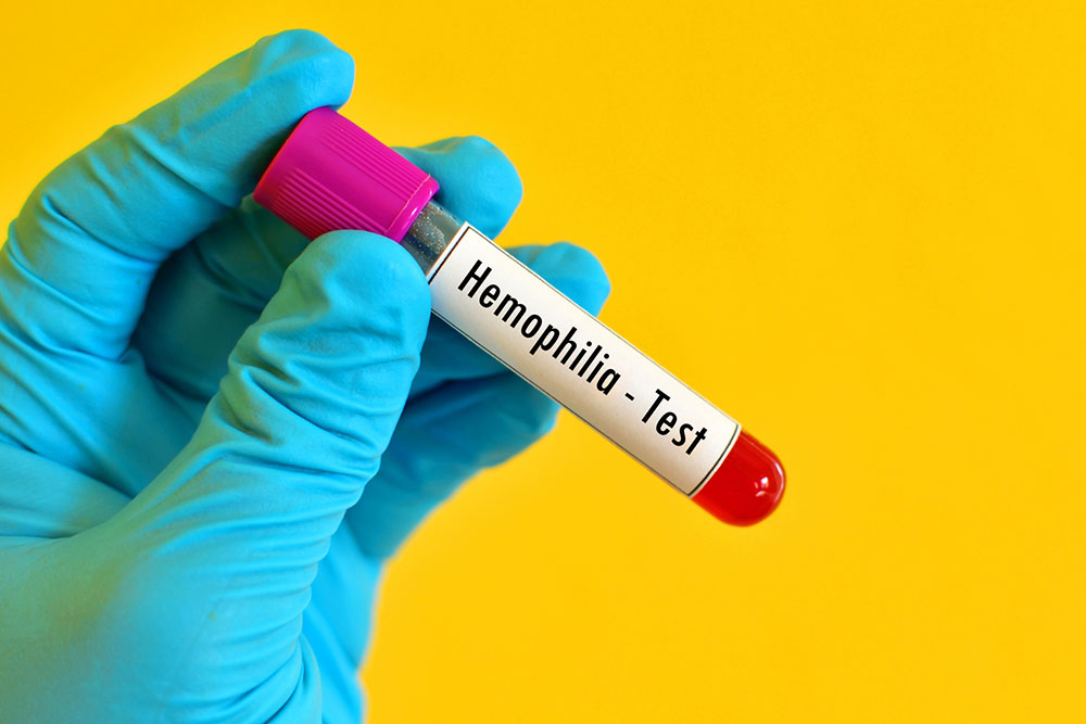 Things you need to know about hemophilia