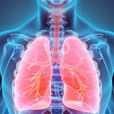 Understanding lung cancer and its symptoms