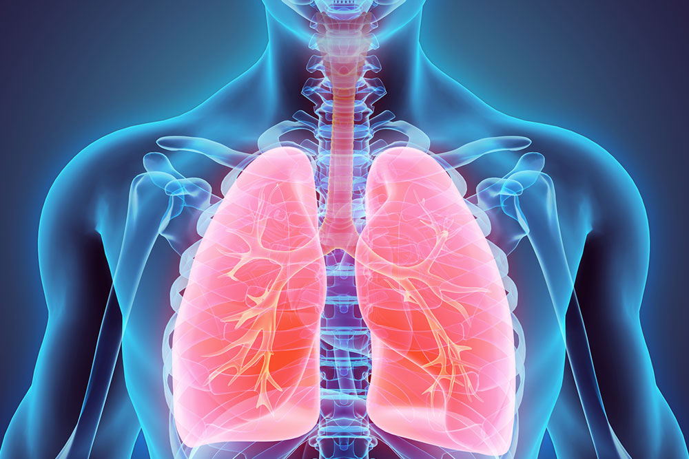 Understanding lung cancer and its symptoms